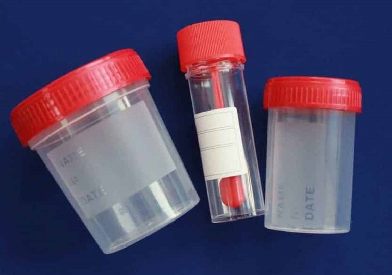 Можно ли, как и сколько хранить анализы в холодильнике Можно ли, как и сколько хранить анализы в холодильнике